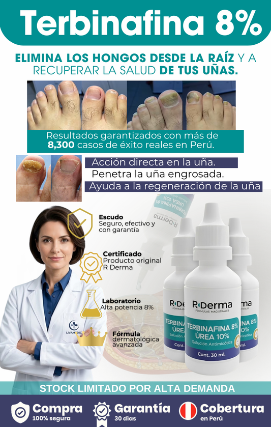 TERBINAFINA 8% UREA 10%